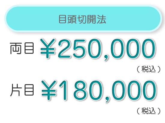 目頭切開法　スッキリ1年保証 両目　¥180,000（税込）　片側　¥100,000（税込）