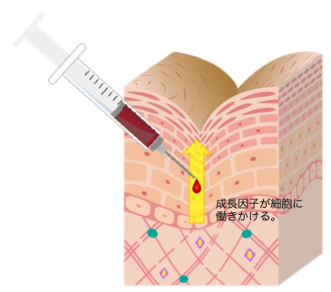 自身の力で肌を若返らせる