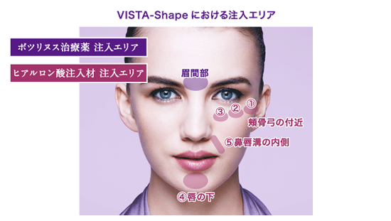 VISTA-Shape