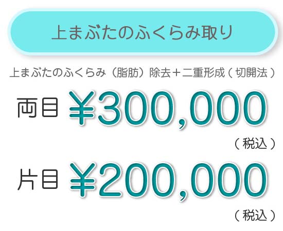 上まぶたのふくらみ取り　スッキリ1年保証 両目　¥300,000（税込）　片側　¥200,000（税込）